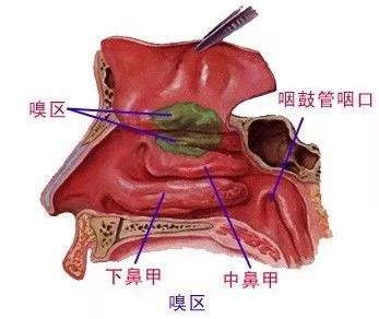 扬州炏焱中医：萎缩性鼻炎的危害