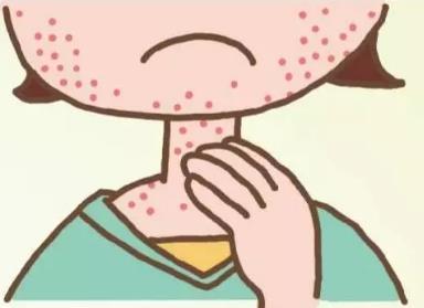 镇江上医堂：如何避免戴口罩引起的痘痘，过敏