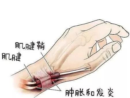 杭州太和堂：（医案）申立国神奇小针刀治疗常见疼痛症状