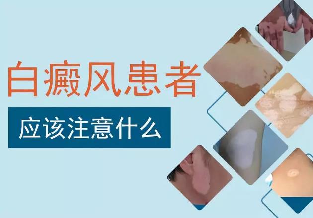 台州龙华中医：白癜风患者的饮水注意事项