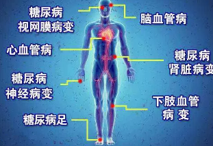广州淳和中医门诊：（医案）中医药治疗糖尿病