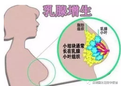 深圳国之瑰宝中医馆：（医案）中医药治疗乳腺纤维瘤