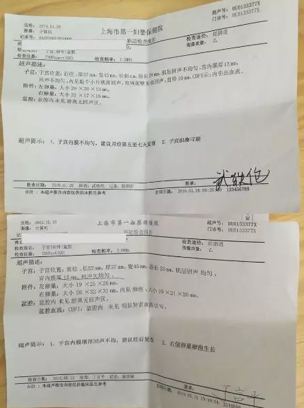 上海张卫忠中医诊所：（医案）四针治愈子宫肌瘤