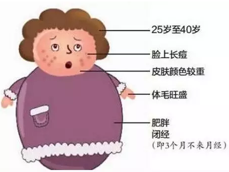 广州康美中医门诊：对付多囊卵巢综合征，首先要....