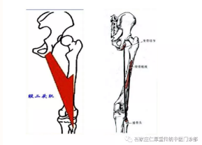 石家庄新华仁厚堂：敲黑板！膝关节痛就是膝关节炎吗？