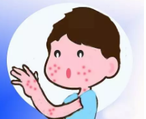 郴州保肤堂：瘙痒不已、反反复复……面对湿疹，该如何是好？