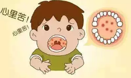 唐山百草堂：中医如何治疗疱疹性咽峡炎？