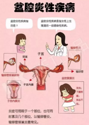 唐山百草堂：九种最常见的妇科病，快来看看你中招了没有！