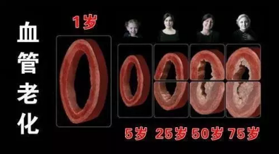 济南华人堂：人体最怕堵的血管在哪里？据说50%的中风都跟它有关？