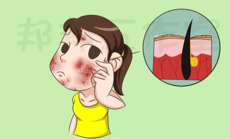 济南麒医堂：湿疹就是湿气重？伤口湿才是湿疹？谁说湿疹一定和湿有关！