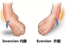 赤峰名医馆：关于崴脚，如何进行正确护理！