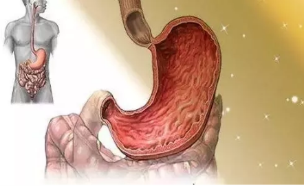 赤峰胃康医院：慢性浅表性胃炎的症状与危害