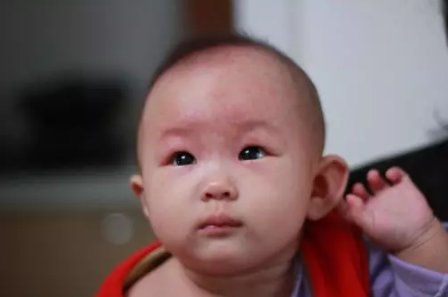 吉林省小儿王中医：湿气多，小儿王教你怎样预防疾病调理身体。