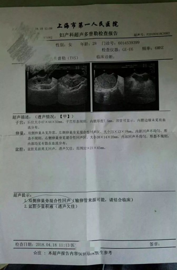 上海应象中医（医案）：陈胜医生治疗卵巢囊肿两个月痊愈