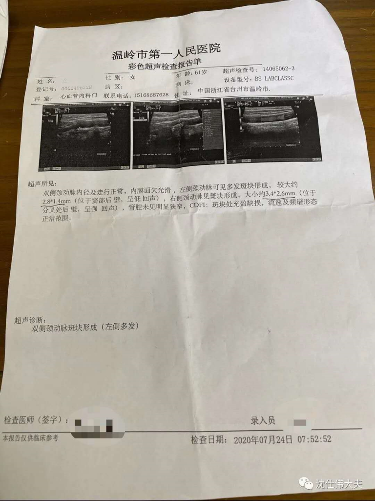上海应象中医（医案）：沈仕伟用中医治疗颈动脉多发斑块及高血压