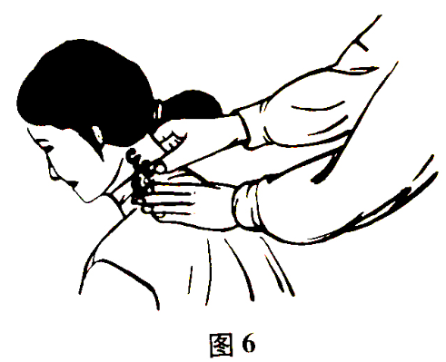 北京有明中医：（医案）罗氏正骨法：胸锁乳突肌损伤的治疗