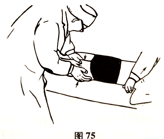 北京有明中医：（医案）罗氏正骨法：股骨颈骨折的治疗和护理
