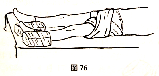 北京有明中医：（医案）罗氏正骨法：股骨颈骨折的治疗和护理