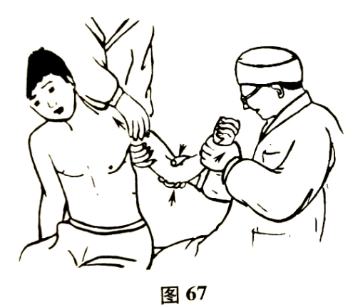 北京有明中医：（医案）罗氏正骨法：肱骨髁上骨折的治疗