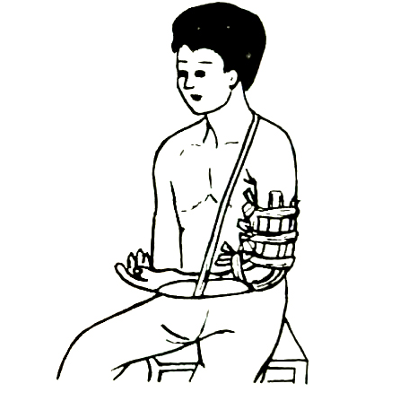 北京有明中医：（医案）罗氏正骨法：肱骨髁上骨折的治疗