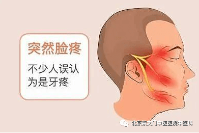 北京崇文门中医：（医案）中医如何治疗三叉神经痛