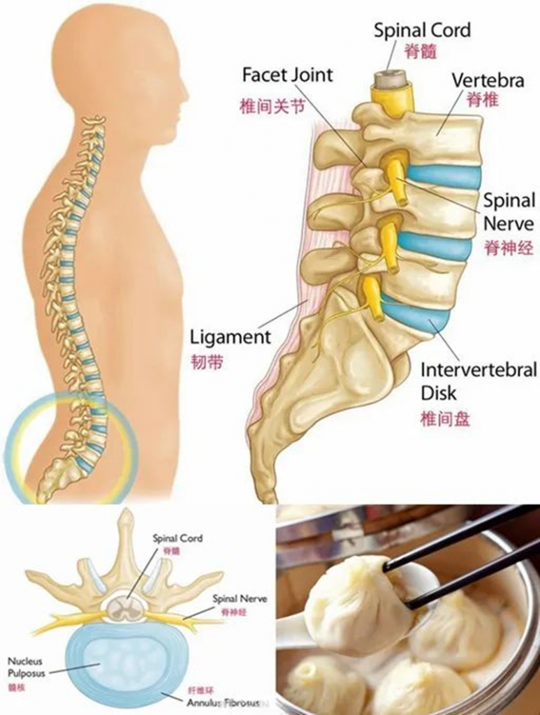 深圳通透堂：腰椎间盘突出症患者常问的10个问题
