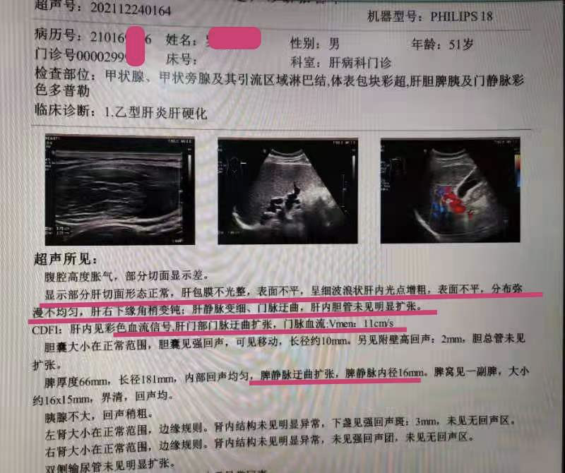 深圳大通中医馆：中药治疗早期肝硬化！