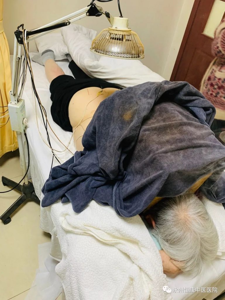 永州恒康中医医院：针灸治疗老人腰痛