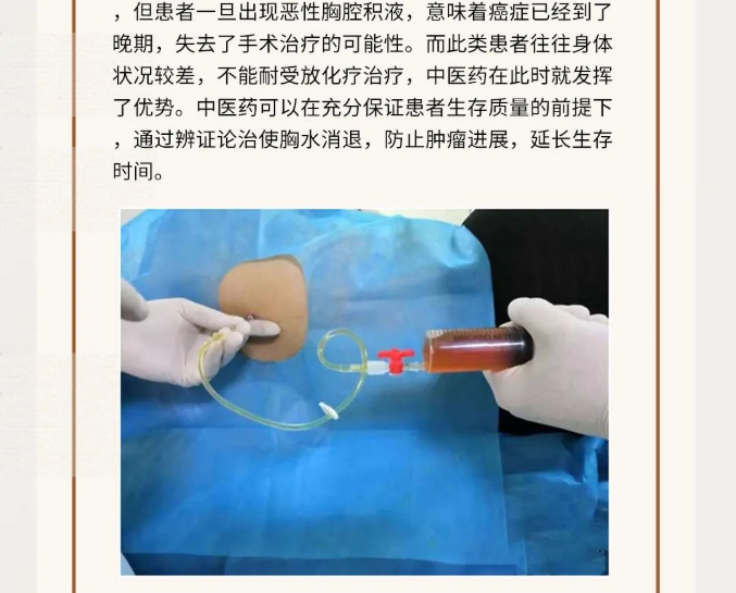深圳维明生中医馆：右肺腺癌患者，抽水引流效果不佳，转而寻求中医药治疗