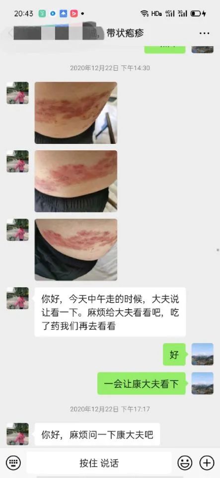 郑州管城康氏中医馆：缠腰龙——带状疱疹