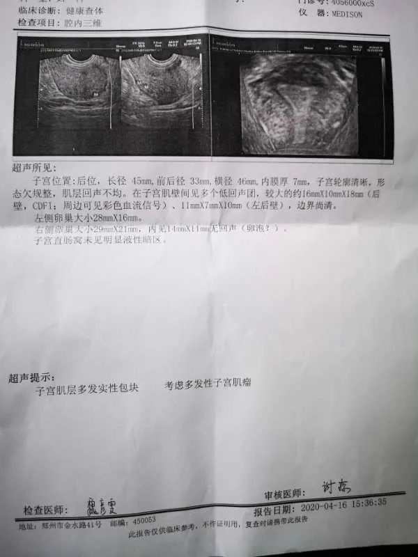 郑州管城康氏中医馆：子宫肌瘤手术后，肌瘤复发，不孕（医案）