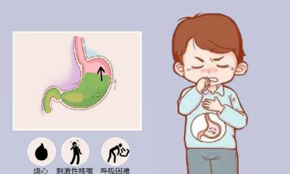株洲同仁国医馆：易飞鸾对胃食道反流性咳嗽的辨证施治