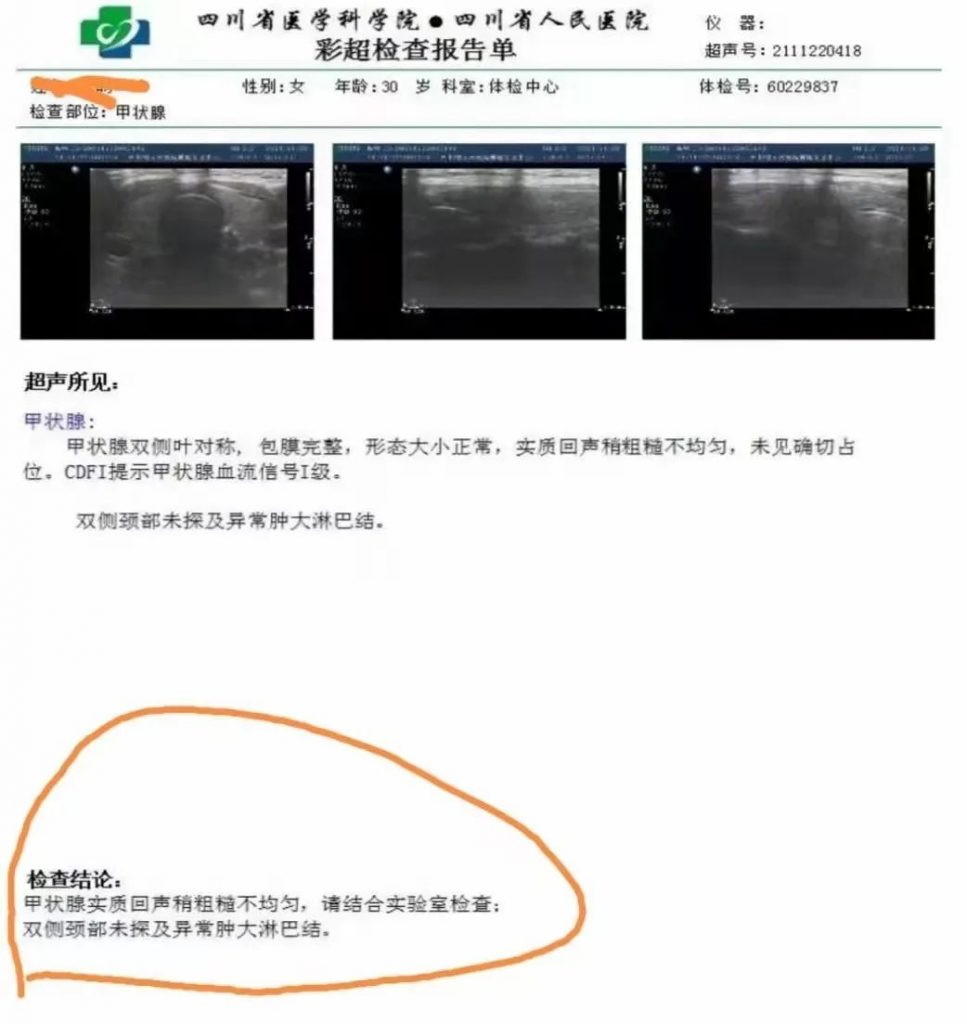 成都杏林春堂国医馆：张健治疗甲状腺结节