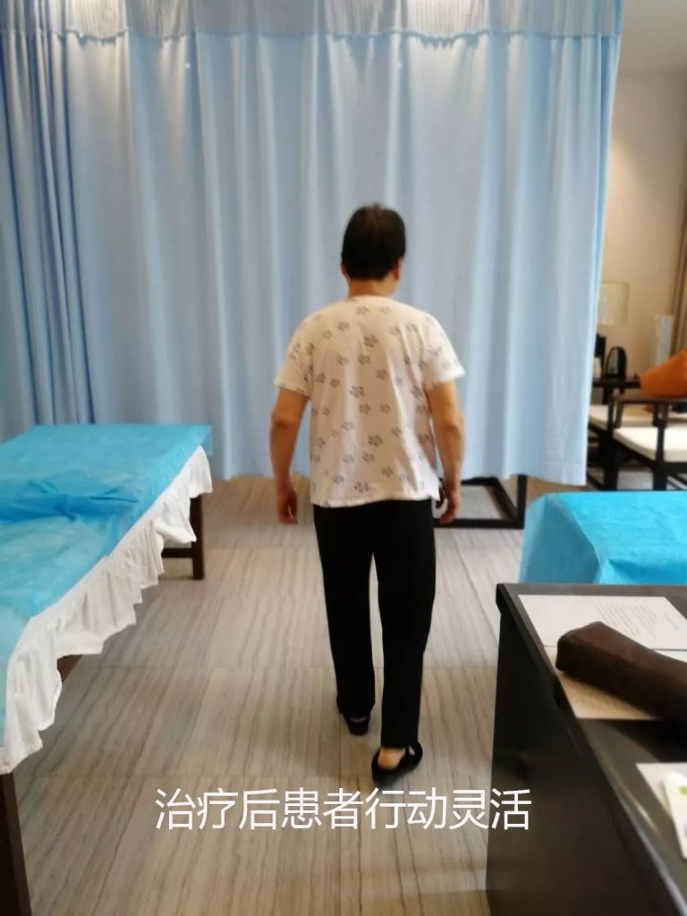 西安真爱广誉远国医馆：杨志春针灸治腰痛