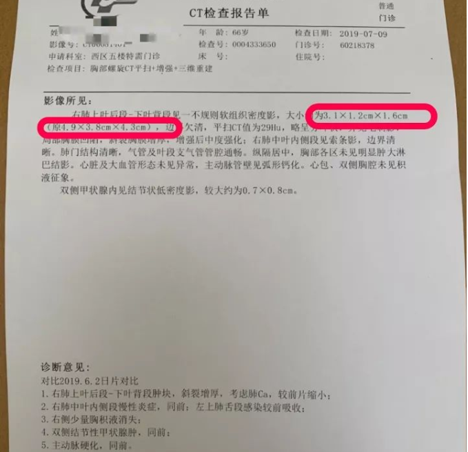 广州范京強古法中医馆：范京强调理肺癌