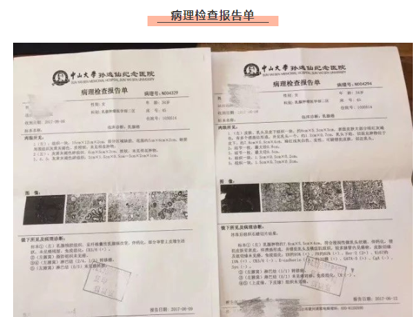 广州范京強古法中医馆：付信平针灸治疗乳腺癌