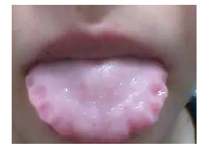 深圳广誉远中医馆：吃饭咬到舌头？当心，可能是生病前兆！