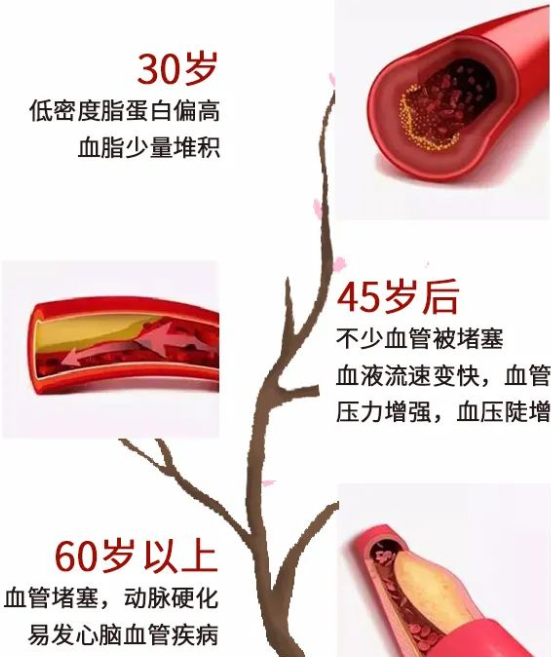 深圳中通国医馆：血管中的“水垢” 您有认真对待吗？