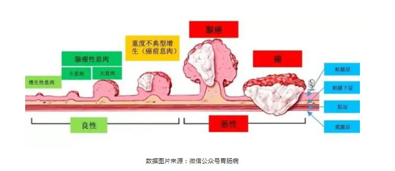 深圳天元中医肛肠医院:大肠癌年死亡20万，80%是中晚期......可是，它早期治愈率90%以上。