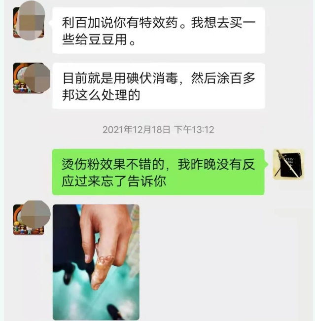 深圳圣路加中医诊所：吴展猷祖传药粉外治儿童手烫伤