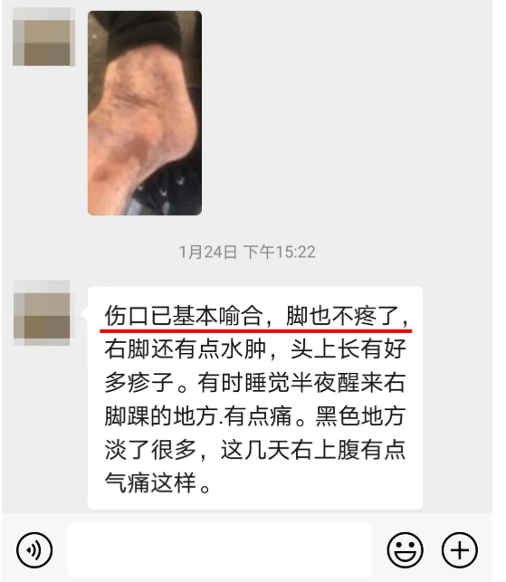 深圳问止中医门诊部：王丹丹调理“老烂腿”