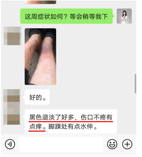 深圳问止中医门诊部：王丹丹调理“老烂腿”