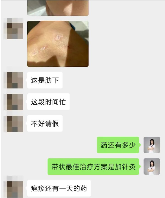深圳问止中医门诊部：王丹丹治带状疱疹