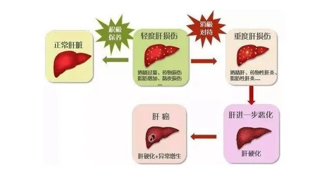 深圳坤元堂中医诊所：夏望红针药灸结合治肝癌合并胆结石