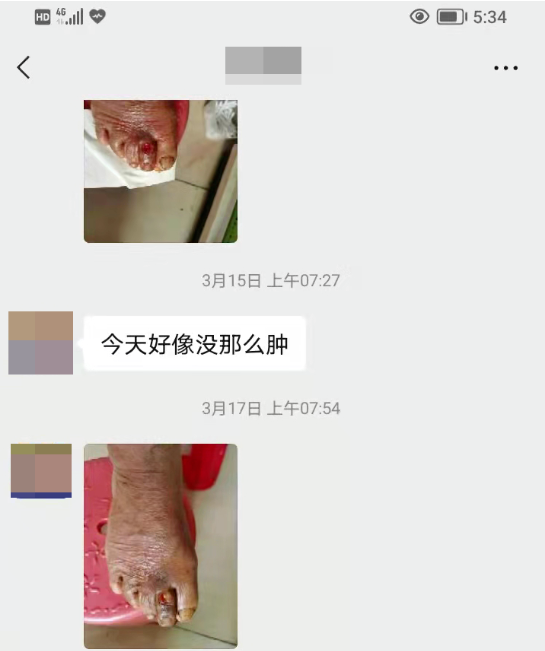 深圳问止中医门诊部：王宇调理糖尿病足