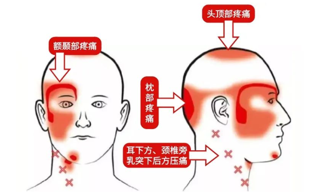 深圳正曲脊柱中医诊所：头痛！怎么办?