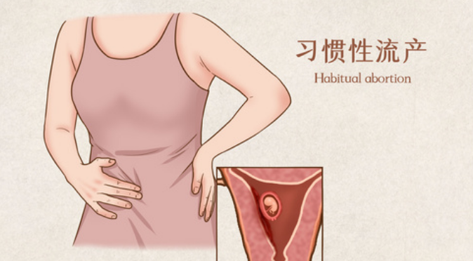 郑州有源中医院：女人为何出现习惯性流产？