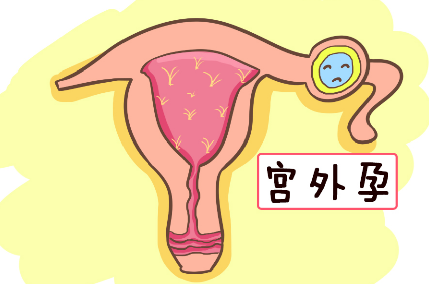 郑州有源中医院：保胎不止是躺在床上不动，别被坑了