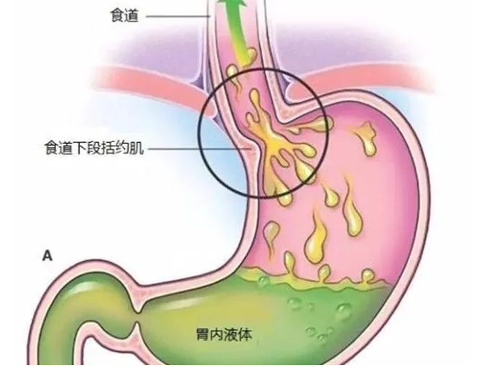 武汉世纪国医堂医院：稳住！萎缩性胃炎伴肠化，有逆转机会！