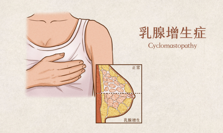 武汉颐年堂国医馆：乳腺哪些情况需要治疗？如何自查乳腺疾病？